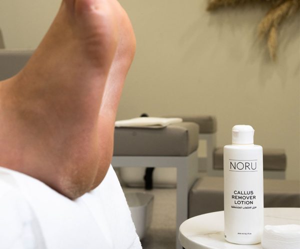 Noru Callus Remover 1 bottle