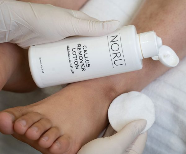 Noru Callus Remover 1 bottle