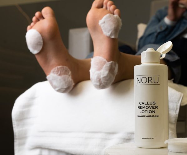 Noru Callus Remover 1 bottle