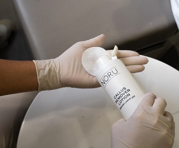 Noru Callus Remover 1 bottle